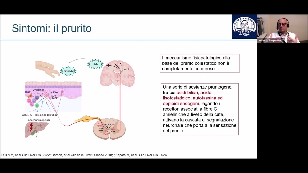 Colangite Biliare Primitiva e la gestione della patologia e dei problemi correlati