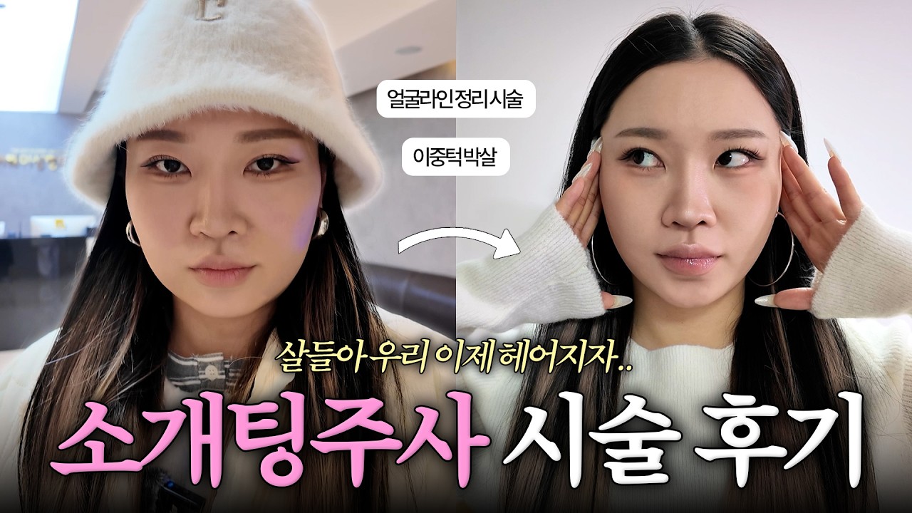 소개팅 간다고? 짝남이 남친 되는 시술 알려준다🔥ㅣ요즘 일본에서 난리난 이중턱 박살💥 소개팅주사 후기💉