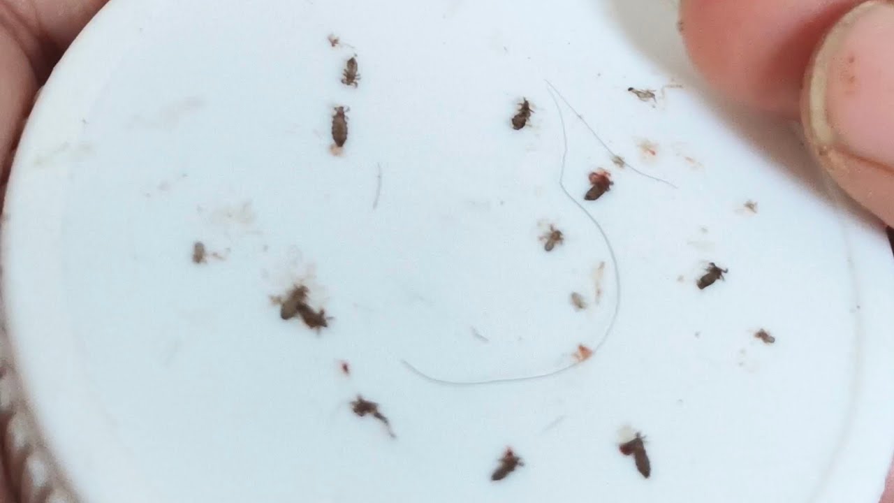 Asmr big sized lice picking from long Indian hair | #asmrlicepicking #nitpicking #longhairasmr 