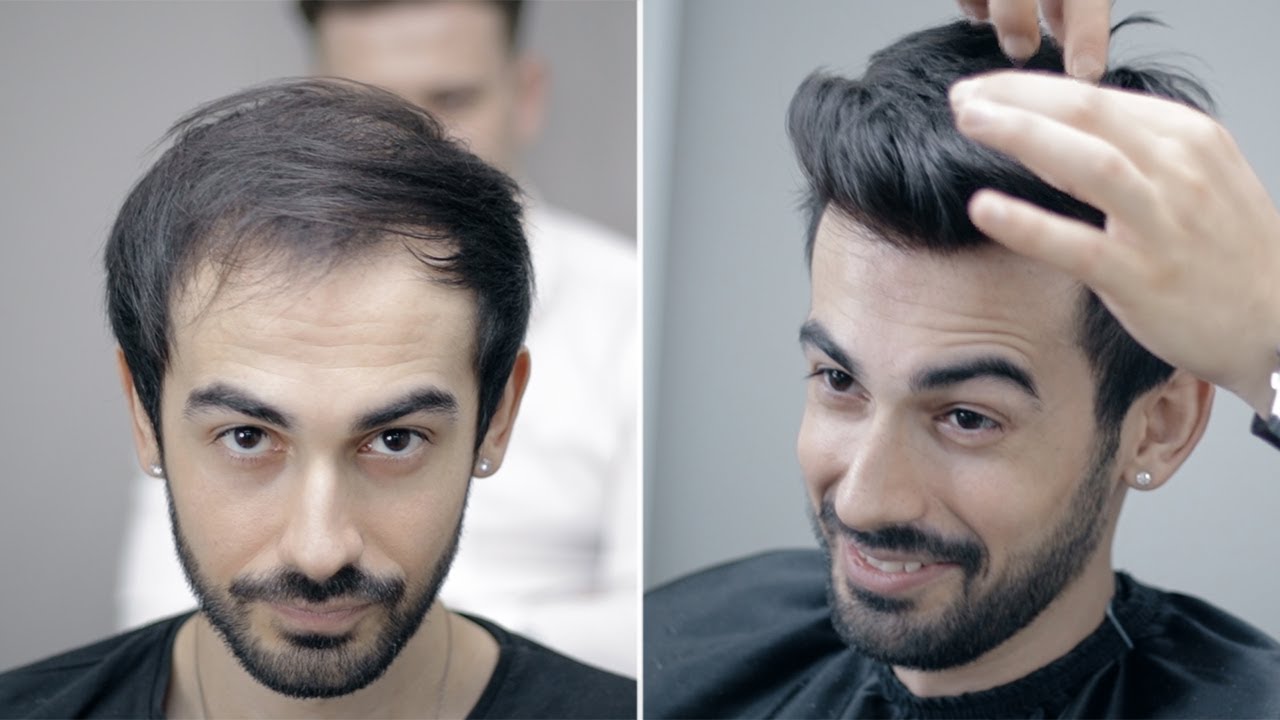 PROTEZ SAÇ DOĞALLIK BİZİM İŞİMİZ - Hair Replacement