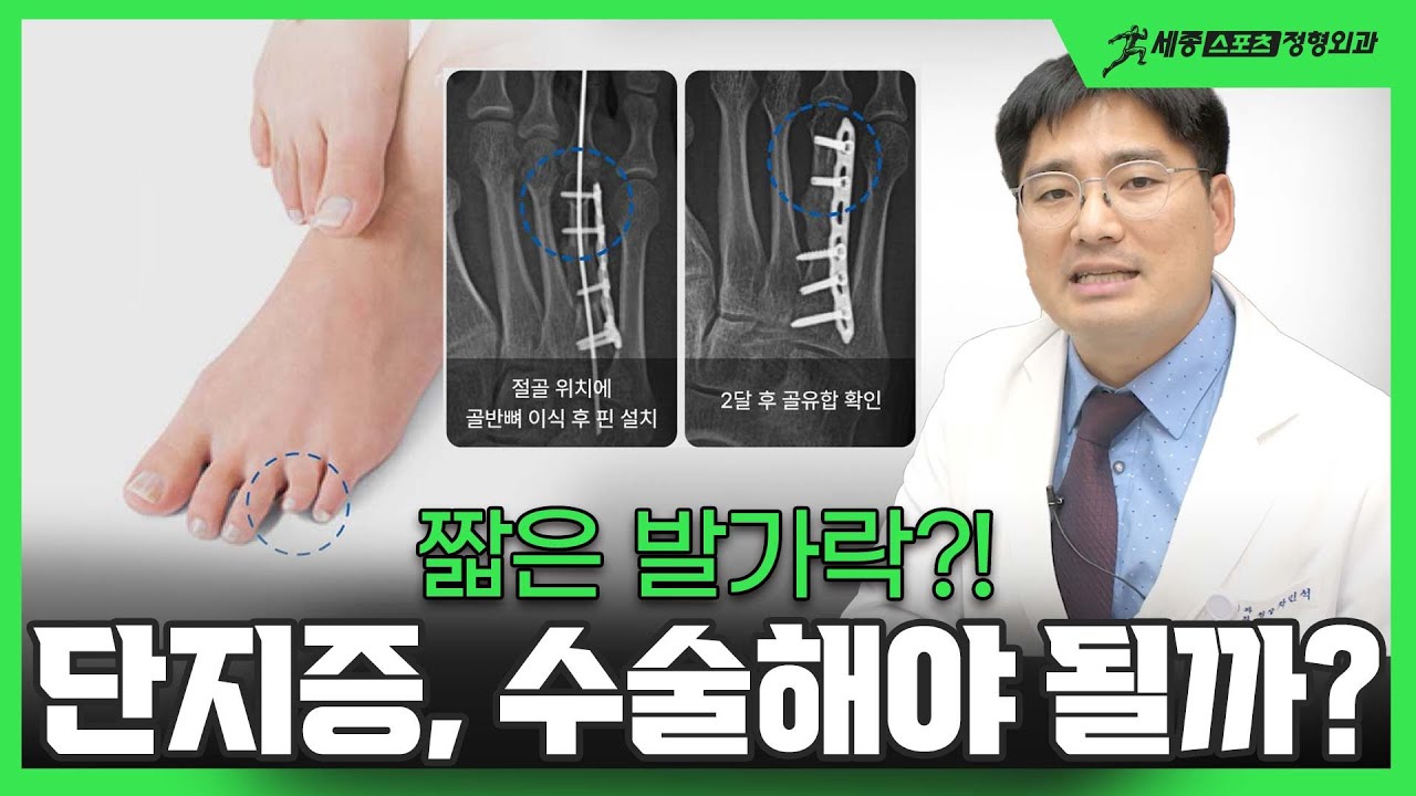 짧은 발가락, 수술해야 할까요? 단지증
