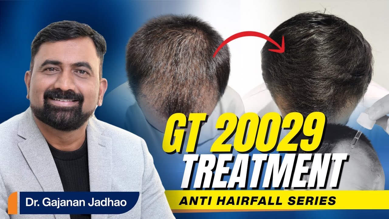 GT20029 Hair Loss Drug Explained | Stage 3 Clinical Trials & How It Fights Hair Fall