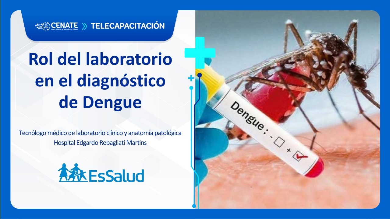 Rol del laboratorio en el Diagnóstico de Dengue