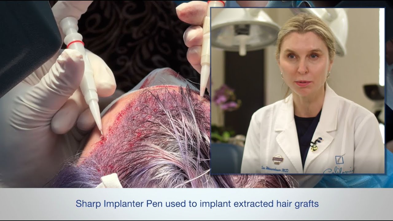 Direct Hair Implantation (DHI) - Promotional vs Proprietary Terms