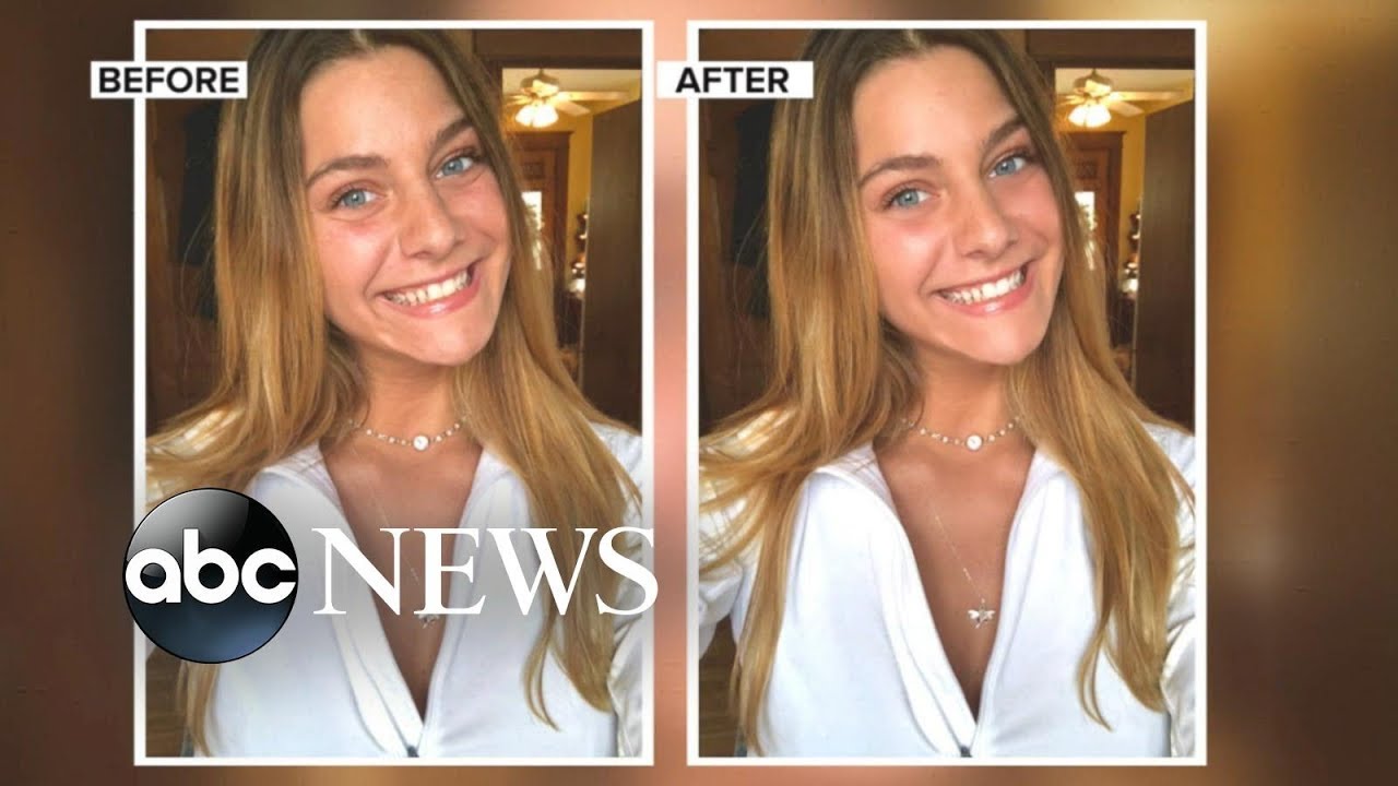 Why are teens turning to Facetune on social media?