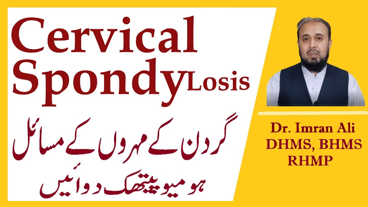 Cervical Spondylosis Best Homeopathic Medicines | Neck Vertebrae Pain Complete Treatment Plan