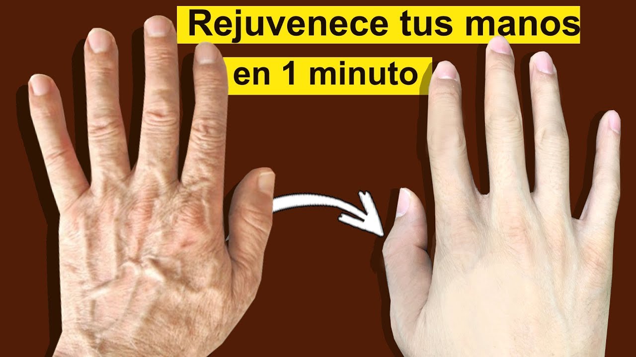 Esto REJUVENECER&Aacute; Tus Manos - Tratamiento Casero