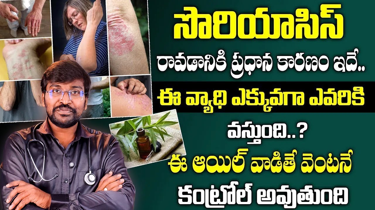 సొరియాసిస్ ఎందుకు వస్తుంది? ఎవరికీ ఎక్కువ? | Dr. Hemanth