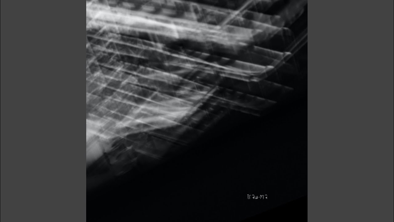 Fracture