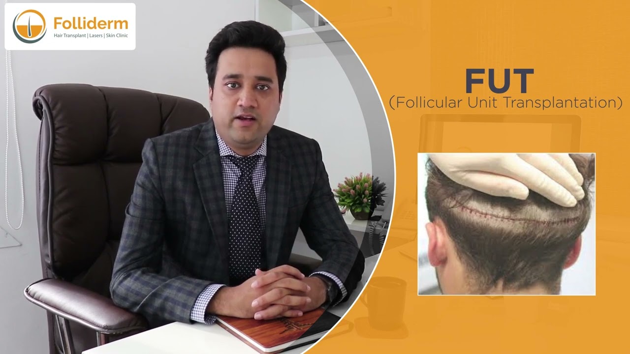 Hair Transplant Techniques Explanation | Process At Folliderm Hair Transplant Clinic in Nepal