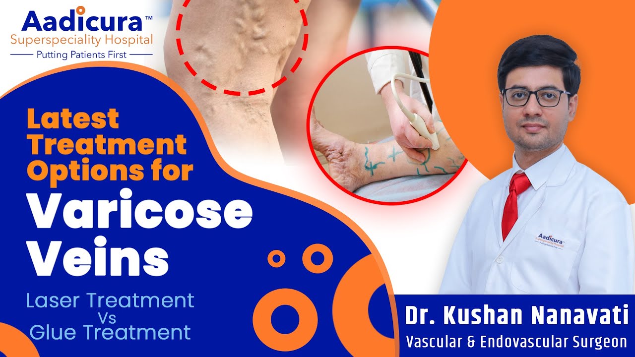 All you need to know about Varicose Veins | Dr Kushan Nanavati | Aadicura Superspeciality Hospital