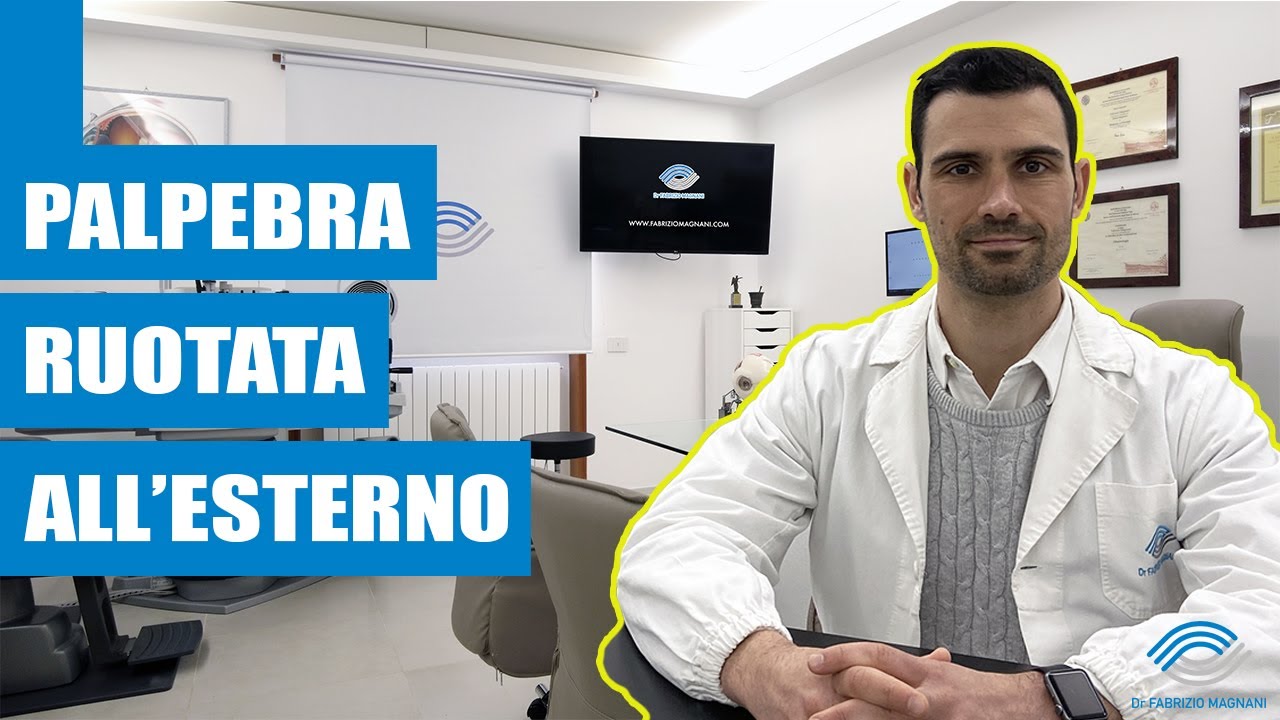 LA PALPEBRA INFERIORE È RUOTATA ALL'ESTERNO - L'ectropion