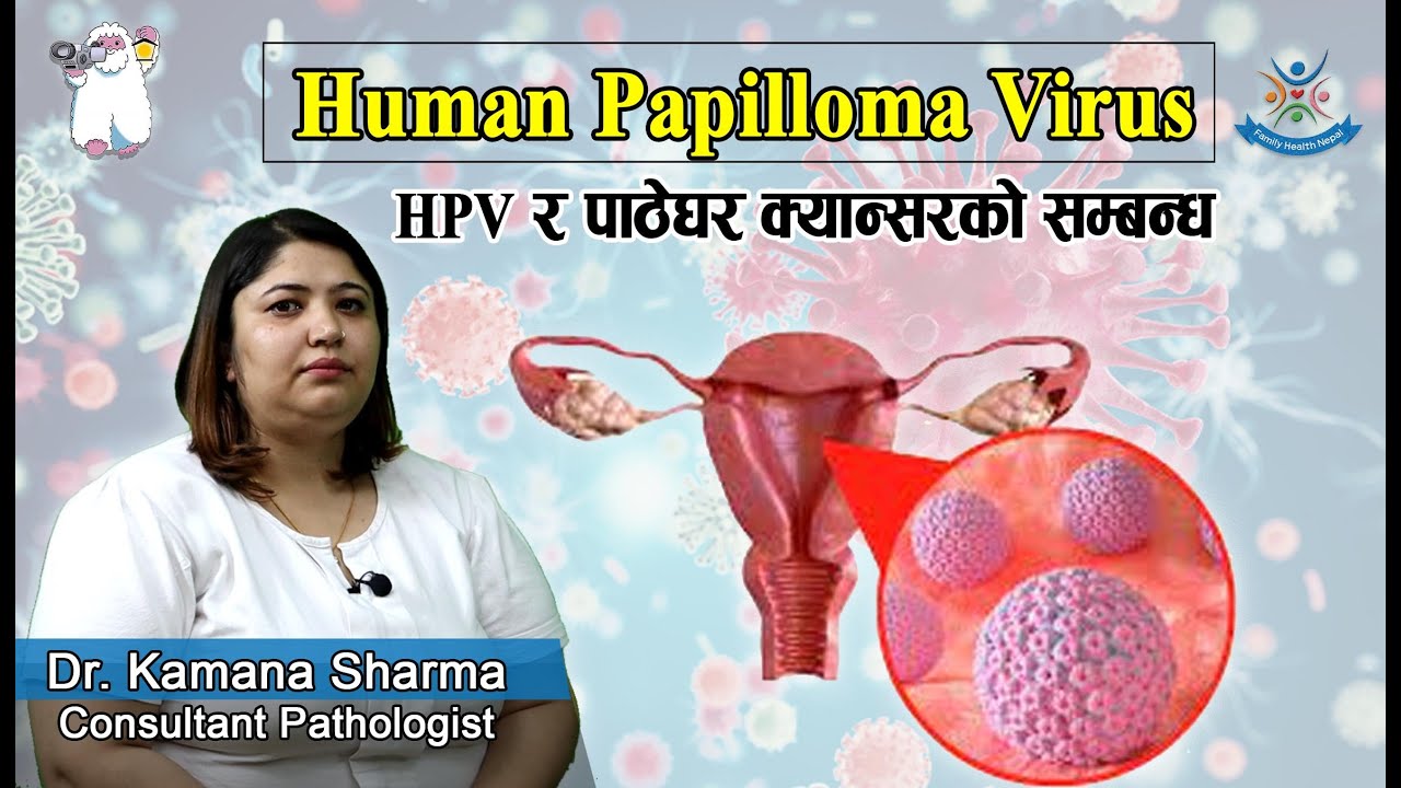 Human Papilloma Virus ( HPV र पाठेघर क्यान्सरको सम्बन्ध) Dr. Kamana Sharma (Consultant Pathologist)