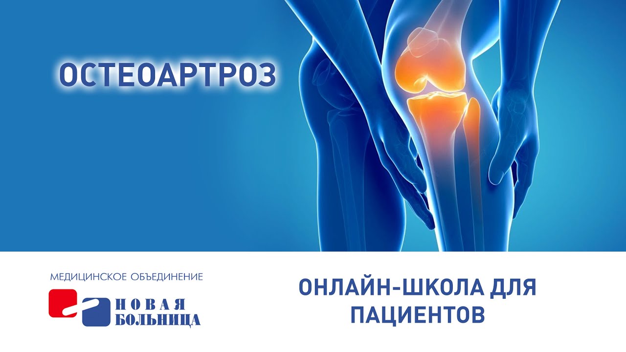 Остеоартроз