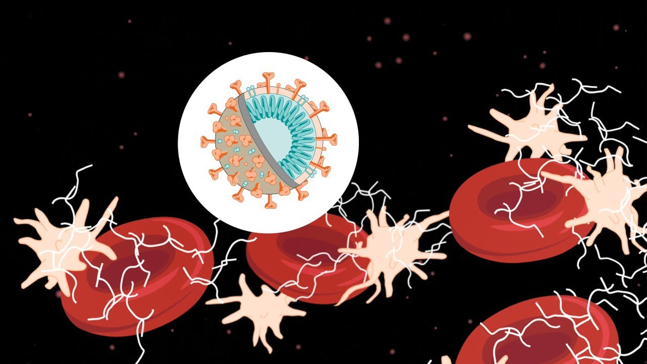 What is thrombosis and how does it impact COVID-19 patients?