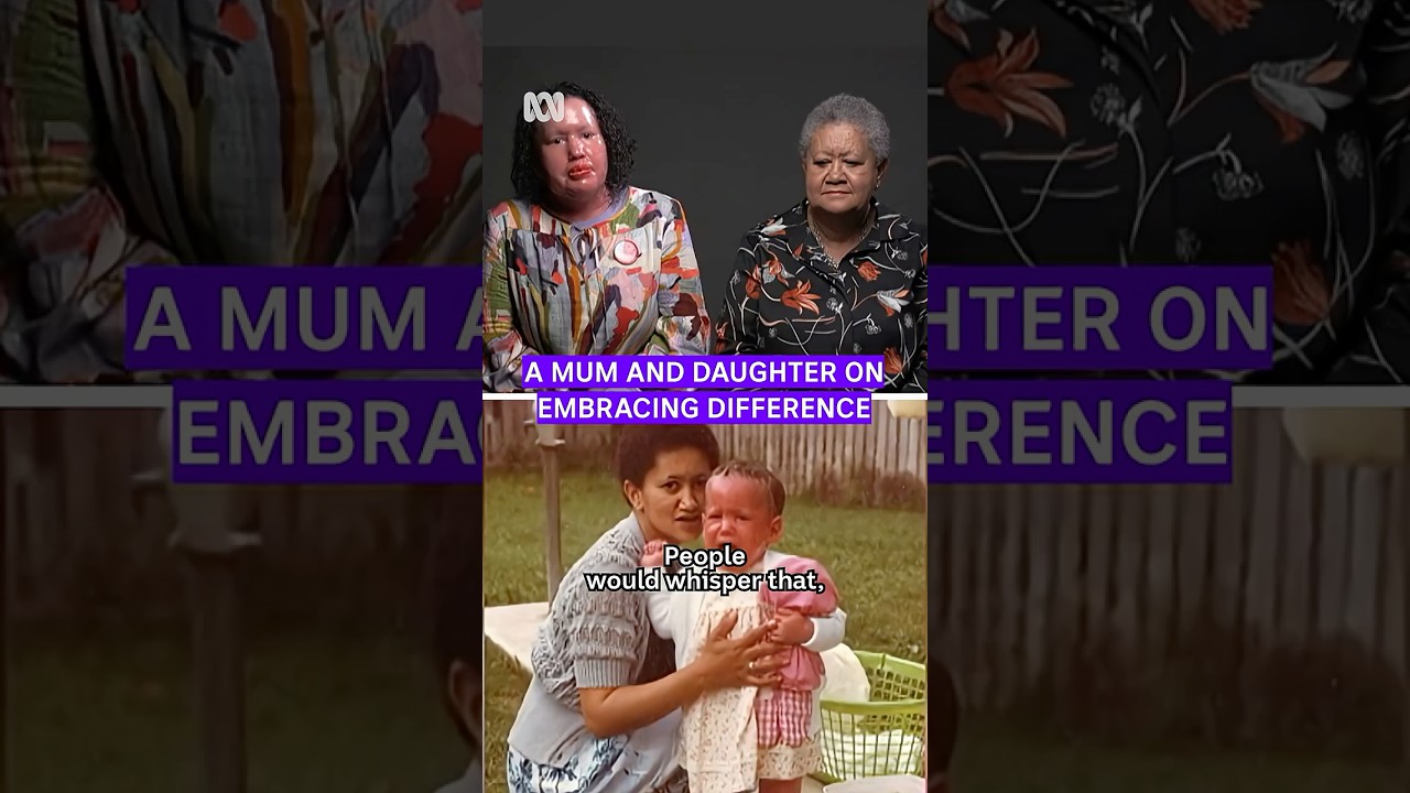 She was born with a rare skin condition, her mum saved her. #respect