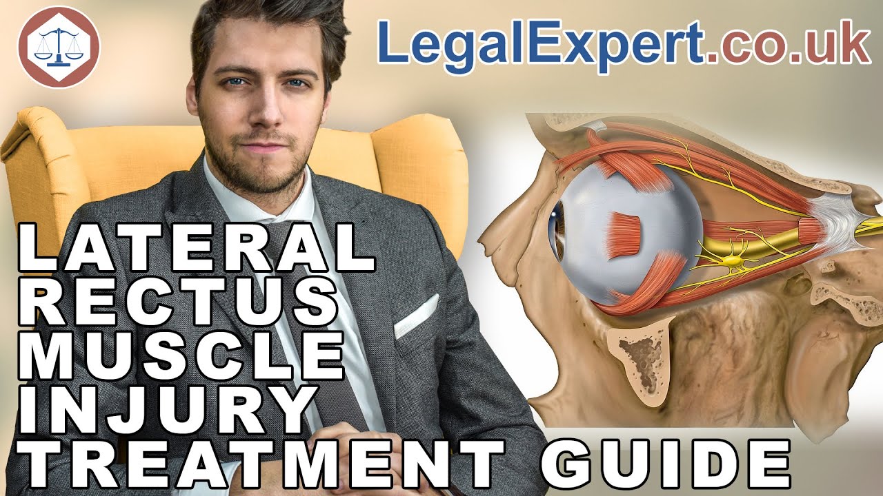 Lateral Rectus Muscle Injury Treatment Guide ( 2019 ) UK