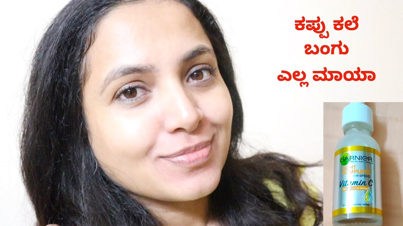 ಮುಖದ ಕಲೆಗಳಿಗೆ 3ದಿನದಲ್ಲಿ ಗುಡ್ ಬೈ | How To Get Rid Of Dark Spots & Facial Marks in 3 Days