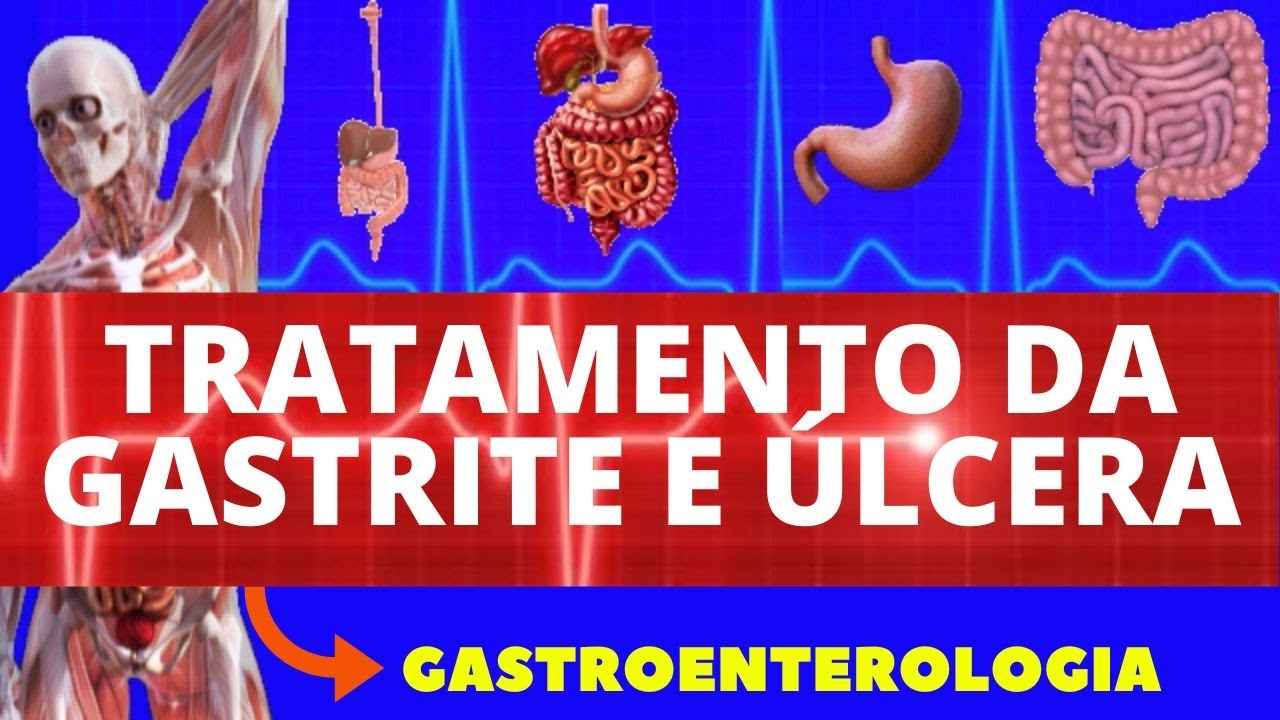 GASTRITE E ÚLCERAS - TRATAMENTO DA GASTRITE E ÚLCERAS - REMÉDIO PARA GASTRITE E ÚLCERAS