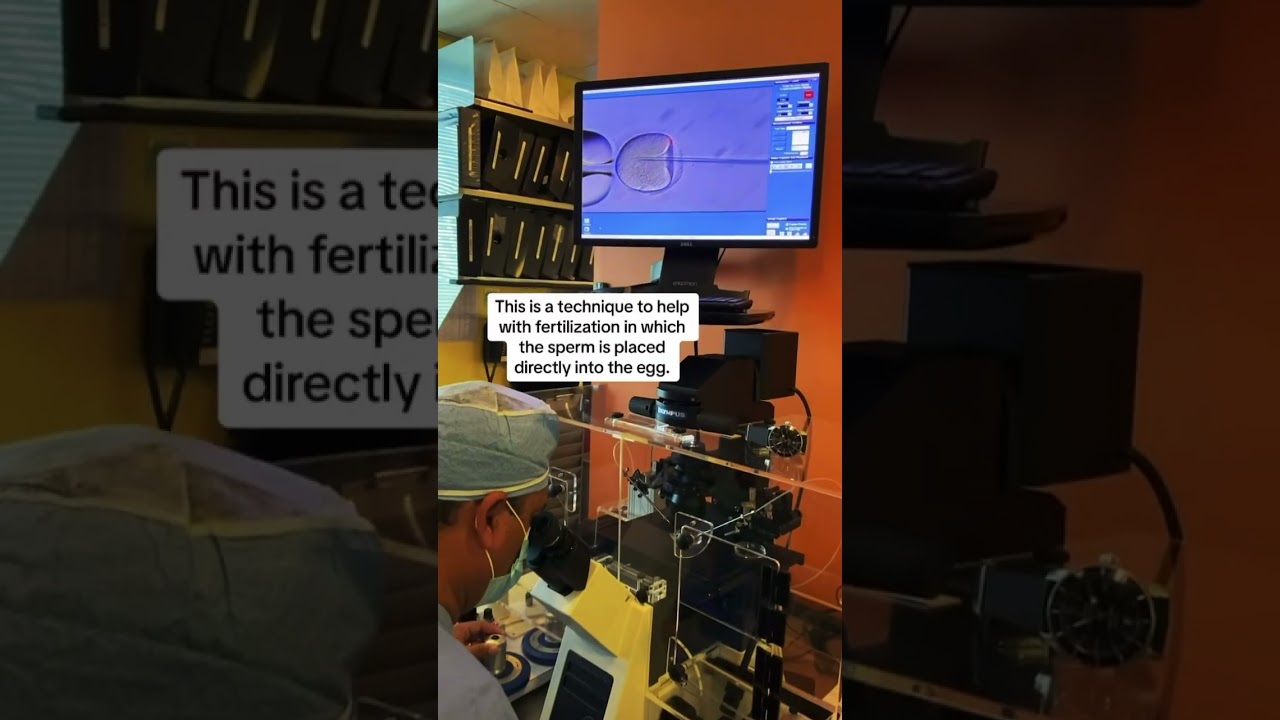 #icsi can improve success rates for male factor fertility issues. #ivf #shorts