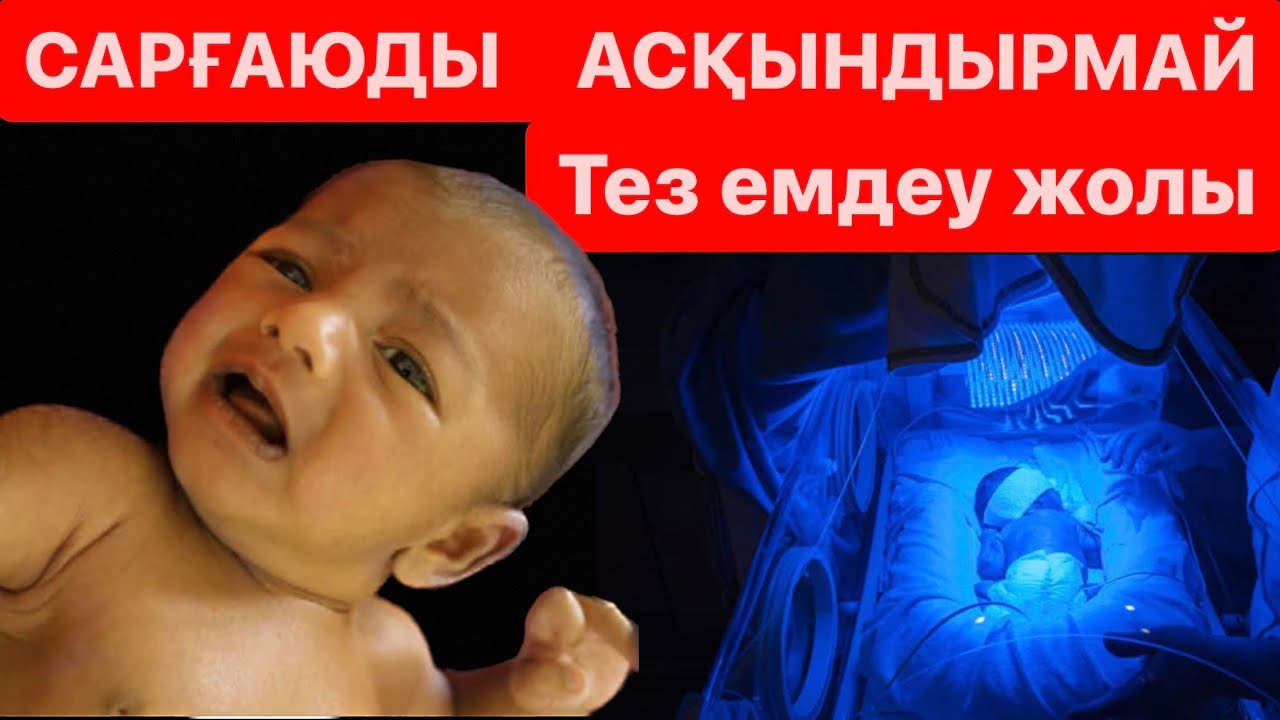 Сарғаю.Балалардағы сарғыштық.Желтуха.Фотолампа