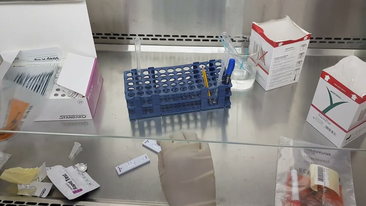 Throat Swab and Culture (Strep Throat Test)