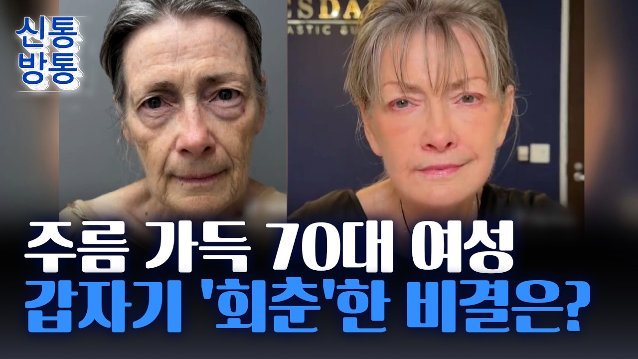 [신통방통] '30년 회춘'한 70대 여성, 얼굴에 뭘 했길래?