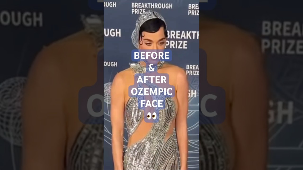 👀BEFORE & AFTER OZEMPIC FACE