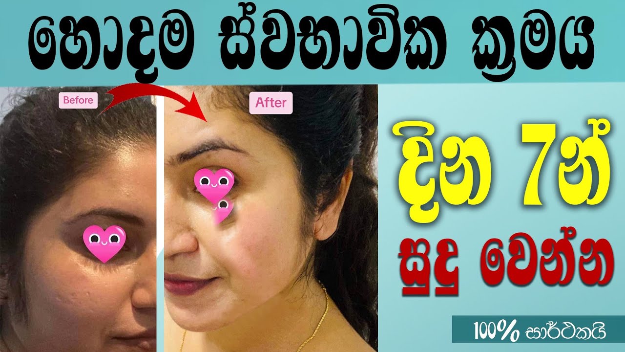 සුදු වෙලා පැහැපත් වෙන්න  දැනට තියන හොදම ස්වභාවික ක්&zwj;රමය. pahapath wenna krama | cream | sudu wenna
