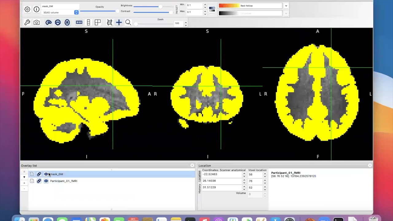Functionnectome Tutorial