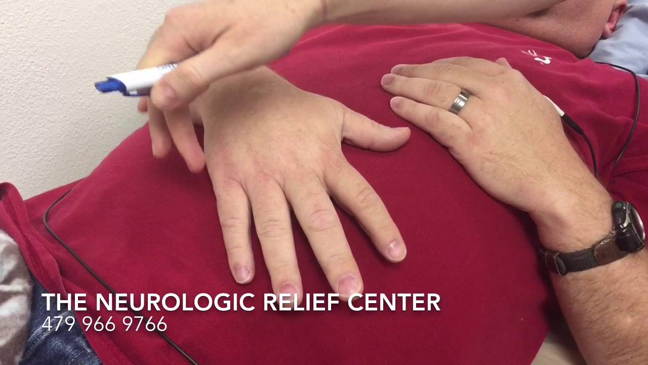 Dr. Katinka's CRPS treatment - Scott's pain is now at 1 for the first time after 10 years!