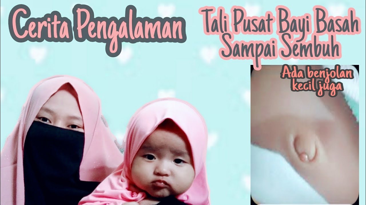 Cerita Pengalaman || Tali Pusar Bayi Basah dan Ada Benjolan Bisa Sembuh
