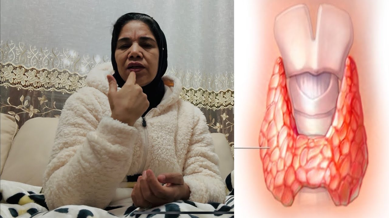 أعراض كسل الغدة الدرقية والأغذية التي يجب تجنبها للحفاظ على جسم سليم 