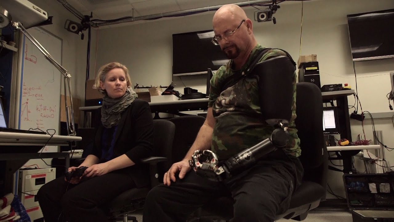 This man is pushing the barriers of advanced arm prosthetics