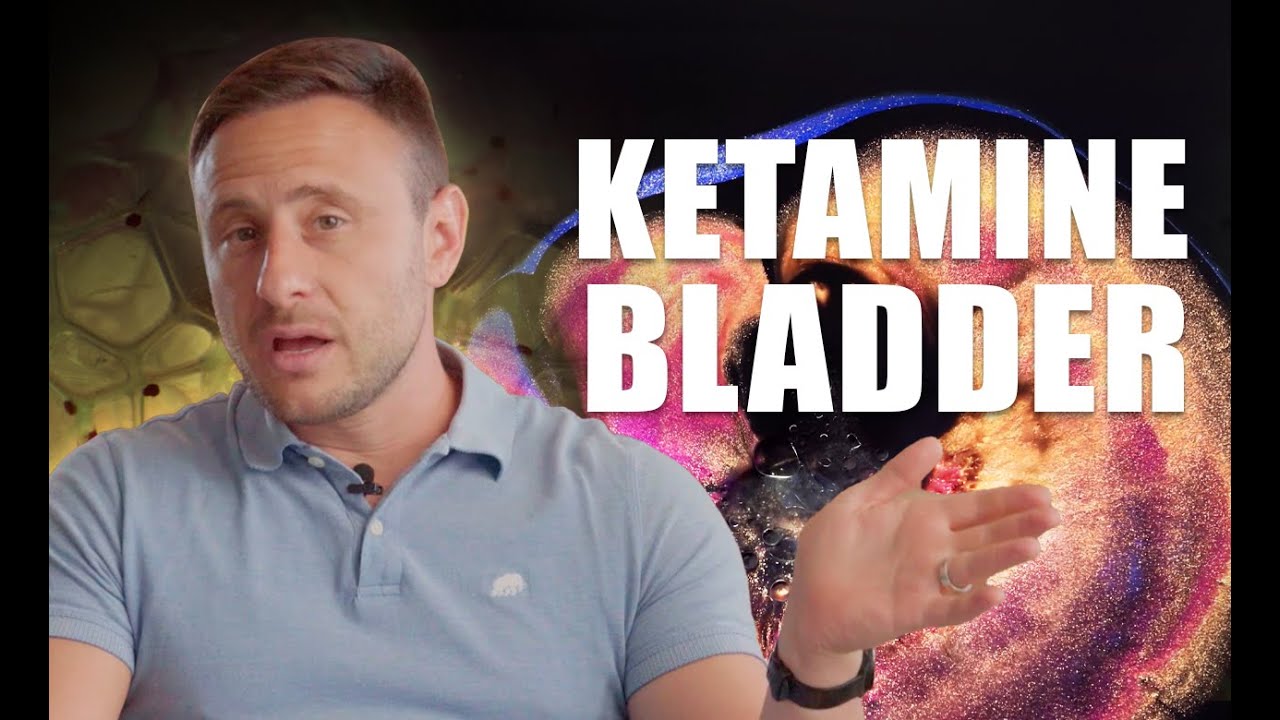 What is Ketamine Bladder…and How Do You Get It?