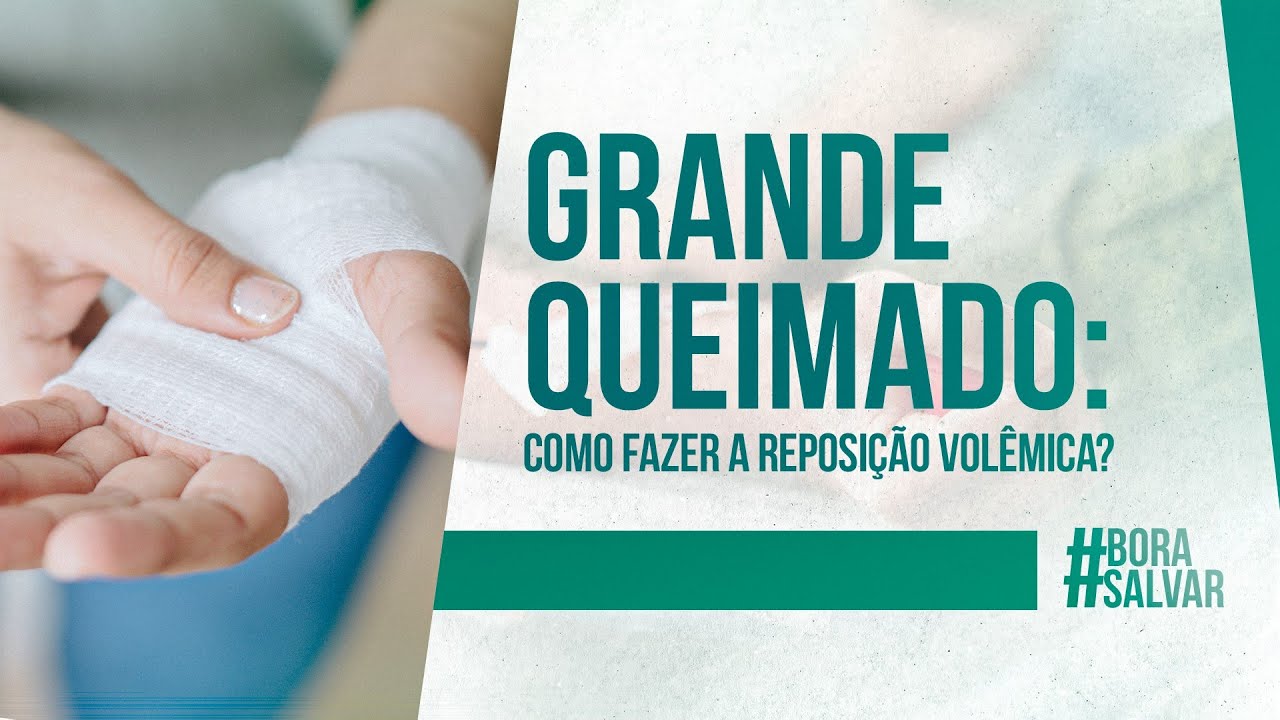 Grande Queimado: Aprenda como a Reposição Volêmica Pode Salvar Vidas!