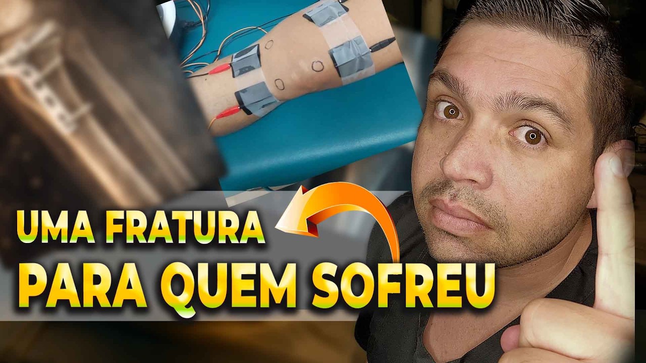 Se você SOFREU UMA FRATURA esse vídeo é para você
