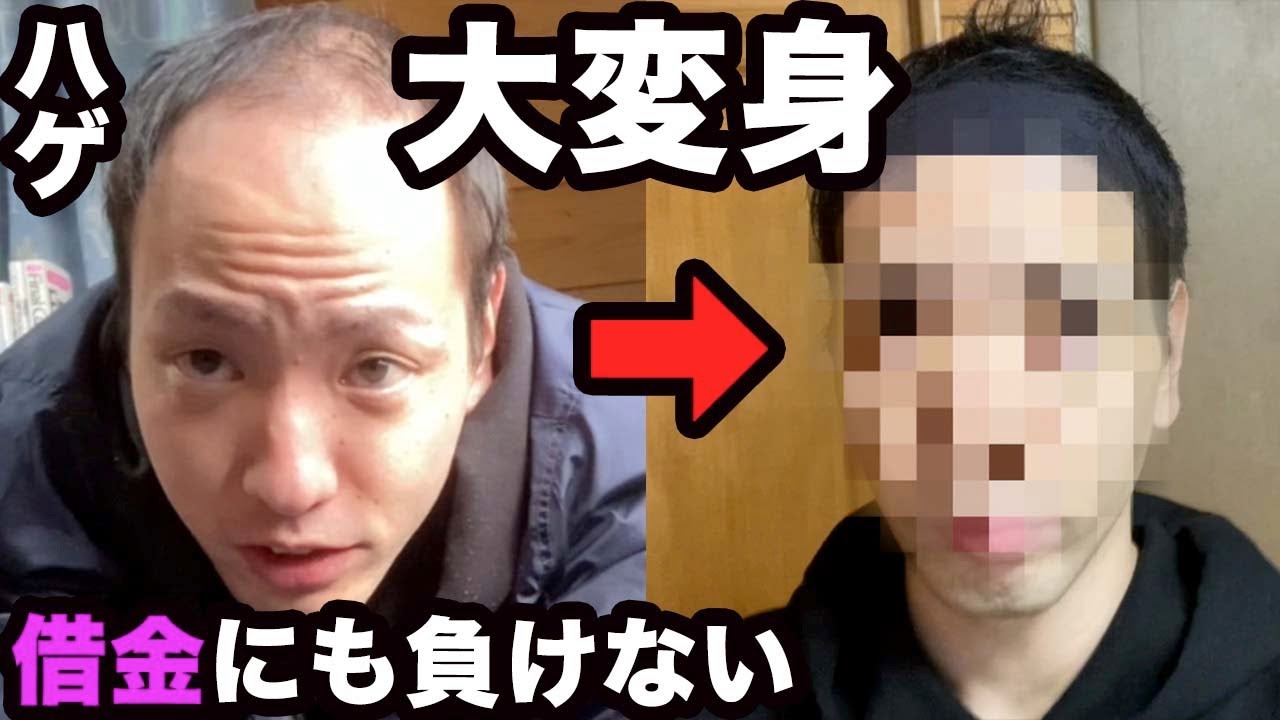 【大変身】若ハゲが増毛パウダーで髪型超変化。はげ隠しの限界ここに極まり【ハゲのヘアセット術】