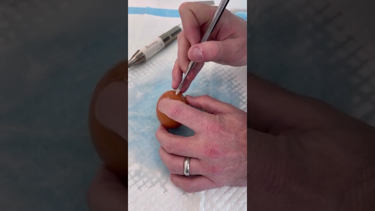 Piezoelectric demonstration (ultrasonic rhinoplasty)