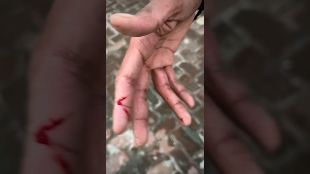Dangerous Manjha😱🧵😱😱#kite #kiteflying #manjha#youtubeshorts