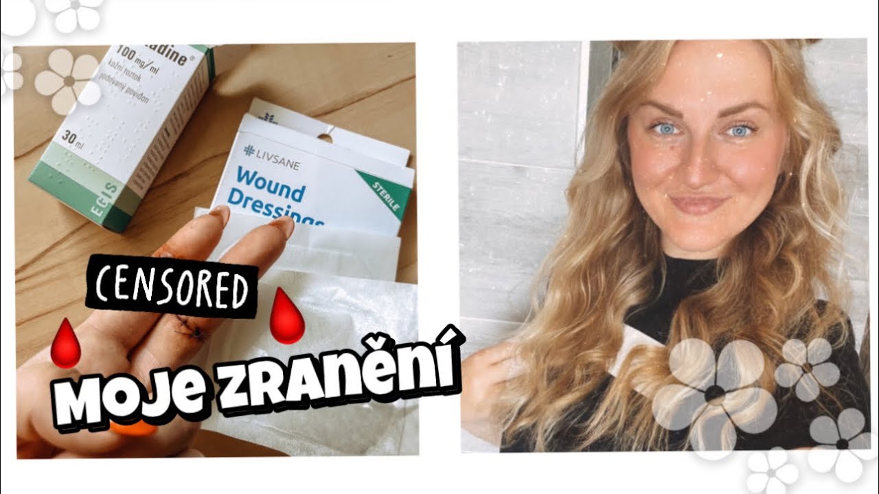 VLOG| moje ZRANĚN&Iacute;🩸, na n&aacute;kupy do MAKRA💶, ztracen&aacute; peněženka🙄