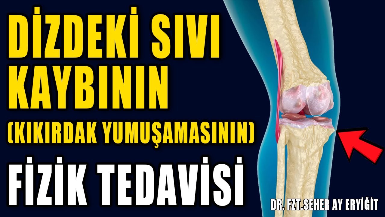 DİZDEKİ SIVI KAYBININ FİZİK TEDAVİSİ #aktifizyo #kıkırdakerimesi #fiziktedavi