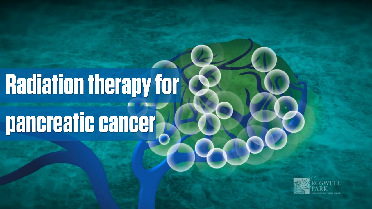 Radiation for Pancreatic Cancer