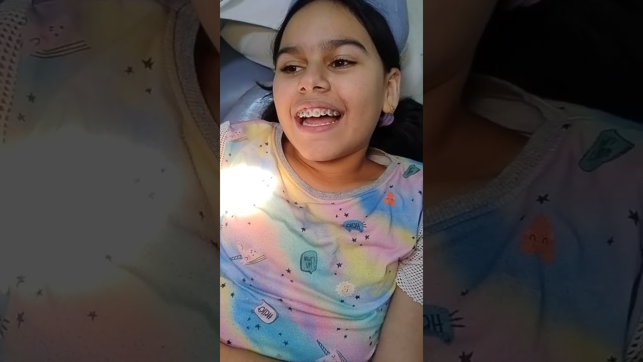 Aparelho Ortodôntico - montagem do aparelho 🦷