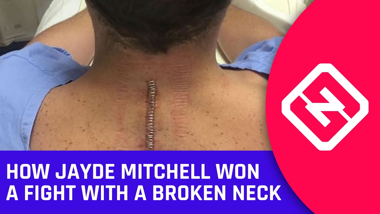 How Jayde Mitchell Won A Fight With A Broken Neck
