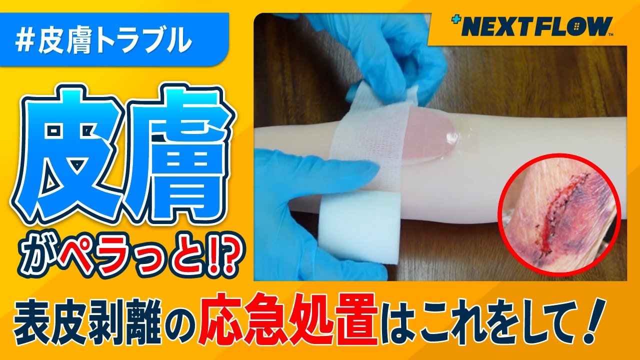 【表皮剥離】訪問看護師が教える緊急時対応方法！実践！
