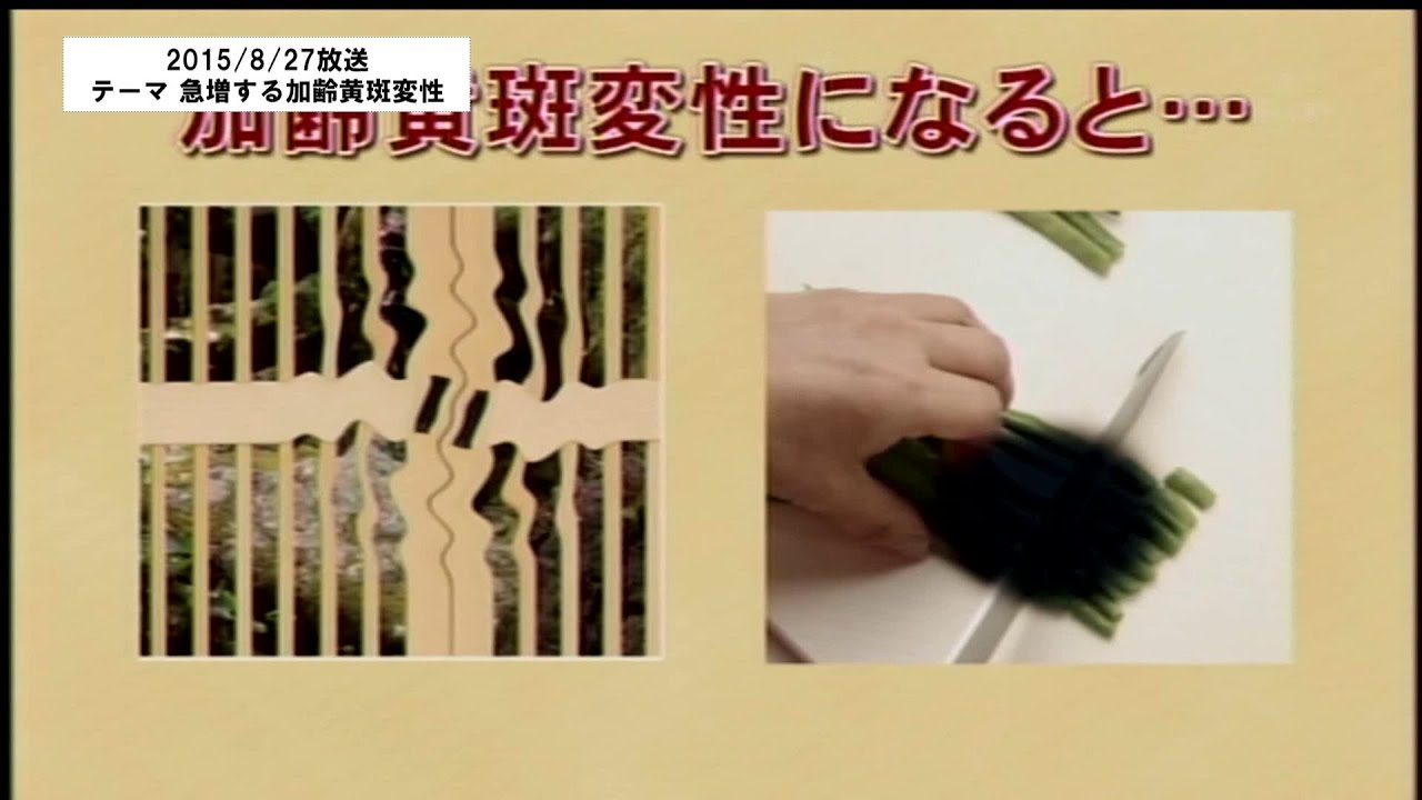 いわて元気○（マル）　【急増する加齢黄斑変性】（2015/8/27放送　ニュースプラス１いわて）