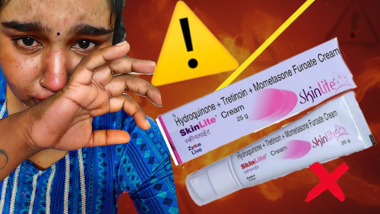 SKINLITE CREAM REVIEW IN MALAYALAM| SIDE EFFECT #skinwhiteningcream #skinlighteningcream| malayalam