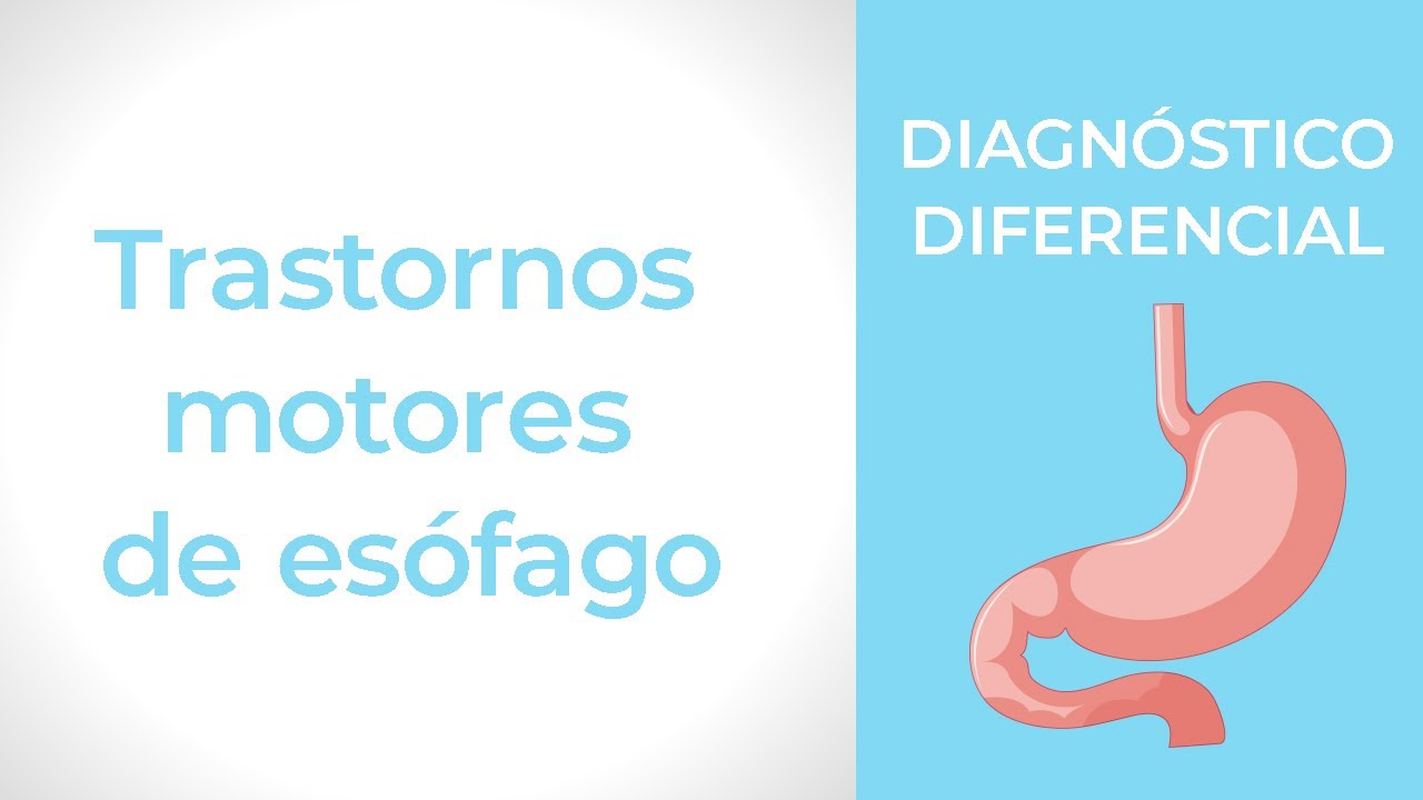 Diagnóstico Diferencial. Trastornos motores de esófago