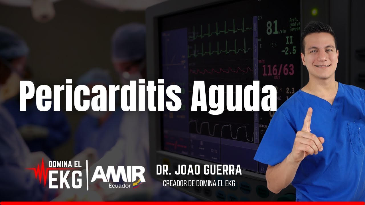 Pericarditis Aguda